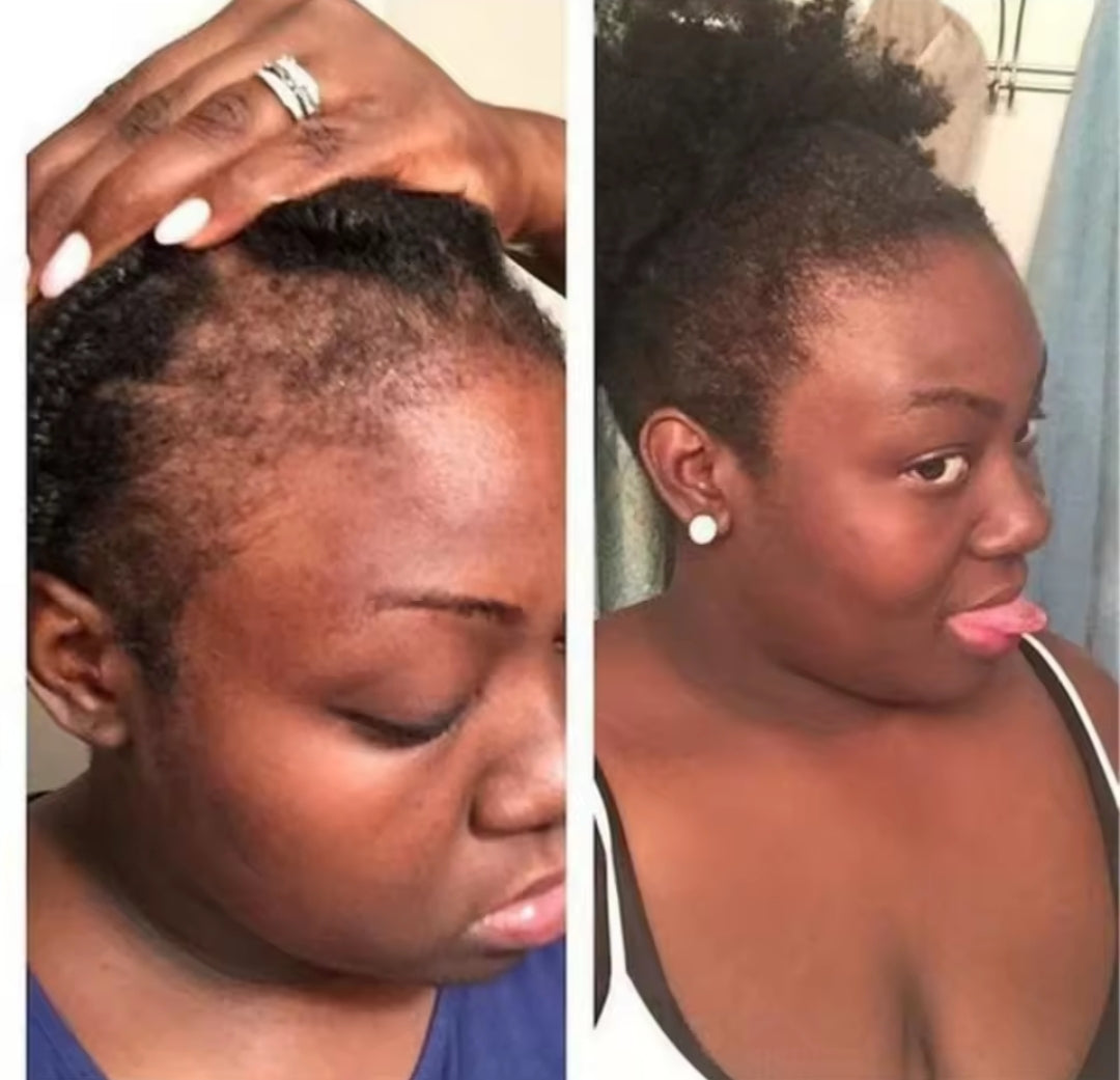 Batana hair growth oil