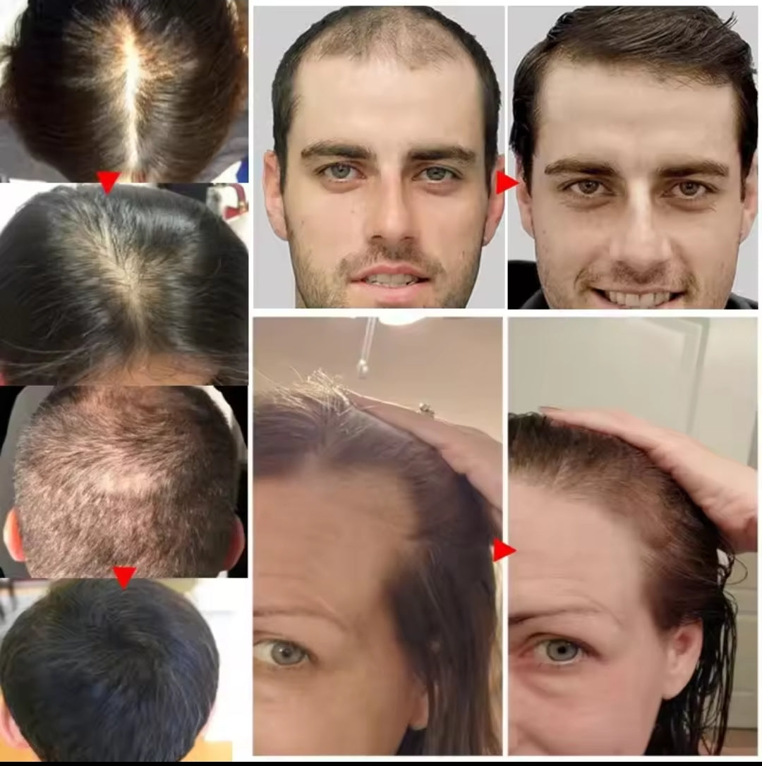 joysuing  hair growth 30 ml