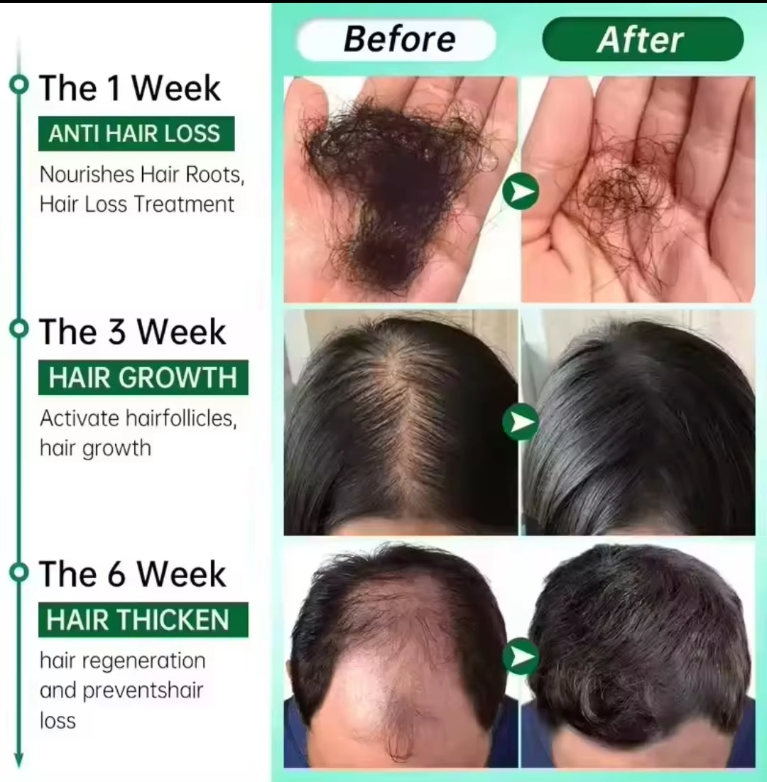 joysuing  hair growth 30 ml